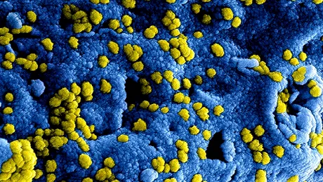 Oamenii de știință sunt în alertă! A apărut un virus de 10 ori mai letal decât Sars-CoV-2
