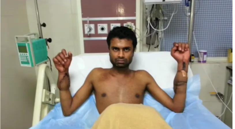 Imagini uluitoare cu un barbat care a suferit un transplant de maini si si-a revenit spectaculos in doar 1 an de la interventie! VIDEO