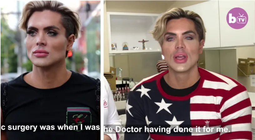 A cheltuit 1 milion de dolari pe operatii estetice ca sa arate asa! Se crede Ken si este cel mai frumos barbat din Brazilia! VIDEO