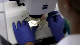 Proteina care mentine pielea tanara a fost descoperita de japonezi