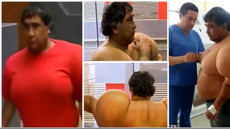 Barbatul care s-a umflat dupa o scufundare. Ce s-a intamplat cu corpul sau. Medicii au elucidat cazul