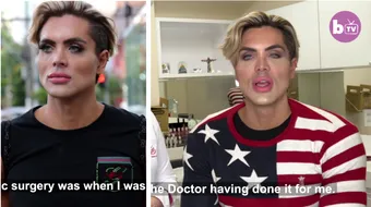 A cheltuit 1 milion de dolari pe operatii estetice ca sa arate asa! Se crede Ken si este cel mai „frumos” barbat din Brazilia! VIDEO