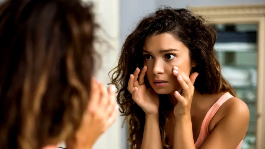 10 remedii naturale și ieftine care te scapă de cearcăne