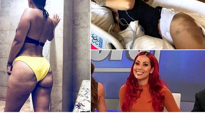 Mutilata de operatiile estetice! A ramas cu gauri uriase in fese dupa ce si-a facut o operatie estetica si era la un pas de moarte! Cum arata acum?!