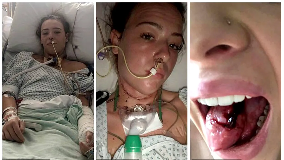 A fost diagnosticata cu ulcer in gura. Boala periculoasa pe care o avea, de fapt. Medicii nu si-au dat seama