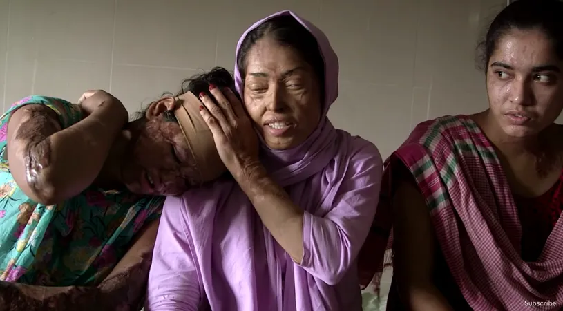 VIDEO! Drama femeilor din Bangladesh arse cu acid de iubitii lor! In fiecare saptamana o femeie este schilodita pe viata! Imagini care te pot afecta emotional