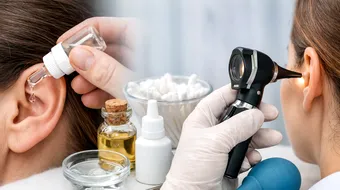 Metode sigure pentru îndepărtarea dopului de ceară din ureche: ce funcționează cu adevărat