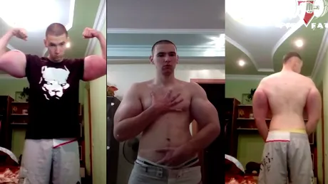 Un rus de 21 de ani si-a injectat ulei in muschi! Dumnezeule, cum a ajuns sa arate! E diform!