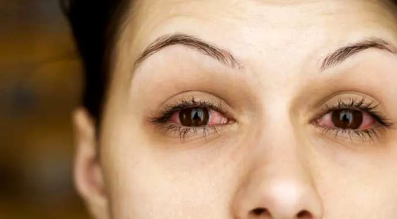 S-a descoperit un simptom NOU! Ce se întâmplă la nivelul ochilor dacă ești infectat cu coronavirus