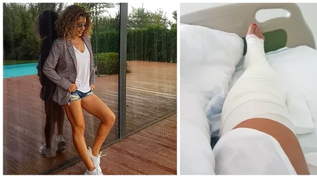 Carmen Bruma si-a operat picioarele. Vedeta avea varice VIDEO