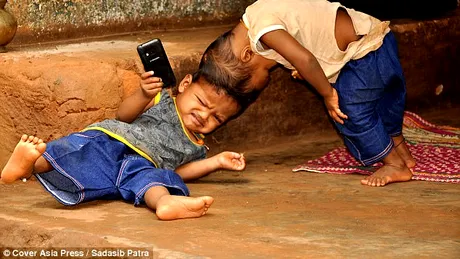 Siamezii uniti la cap: parintii lor viseaza ca intr-o zi, baietii sa duca vieti nomale