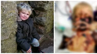 Baiat de 4 ani, mort dupa ce a mers o zi la scoala. Ce a patit micutul