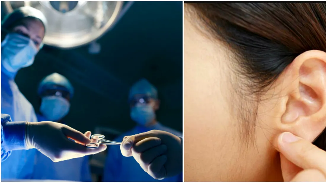 Transplant ca in filmele SF! Aceasta femeie isi creste o noua ureche in propriul corp. E uimitor la ce nivel a ajuns de fapt medicina VIDEO