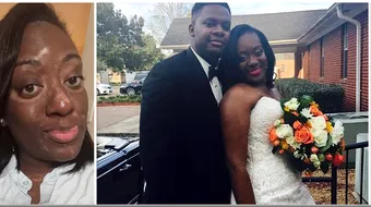 Drama unei mirese: ce a patit tanara asta cu cateva saptamani inainte de nunta! Mirele i-a spus ca e frumoasa, dar…