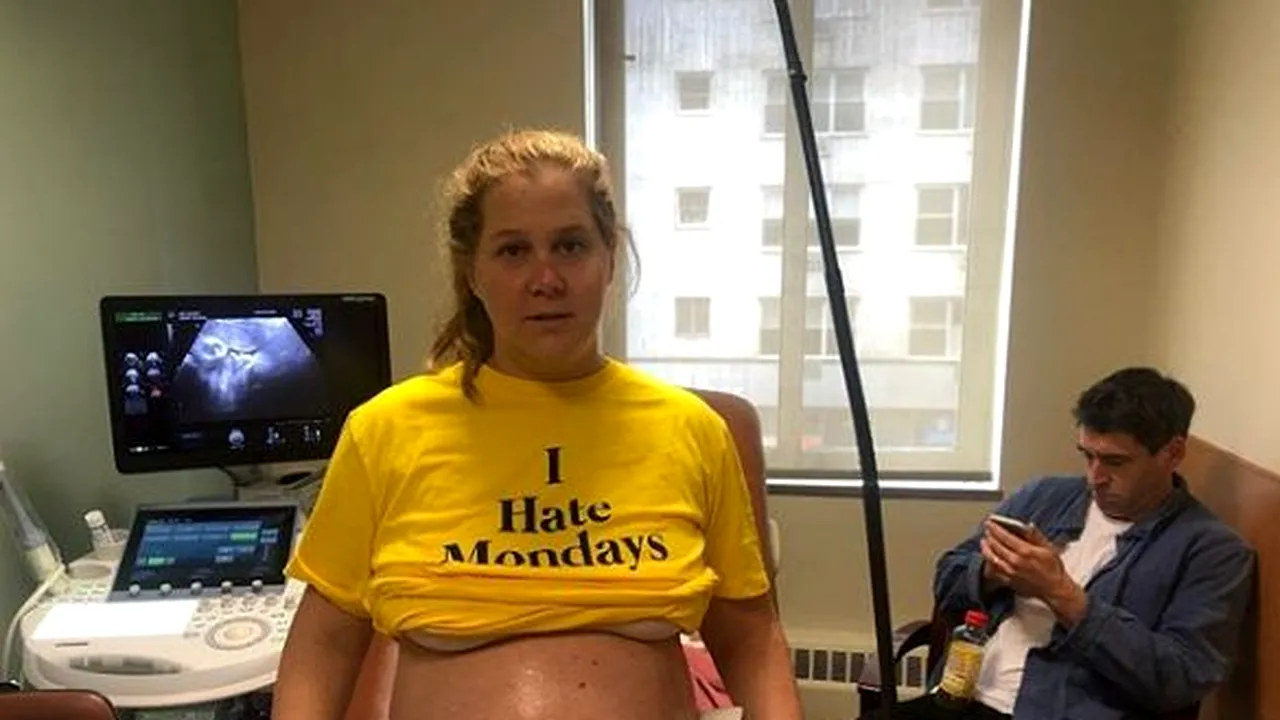 Amy Schumer a nascut un baiat, la cateva ore dupa Meghan Markle. Cum se simte actrita (2) 