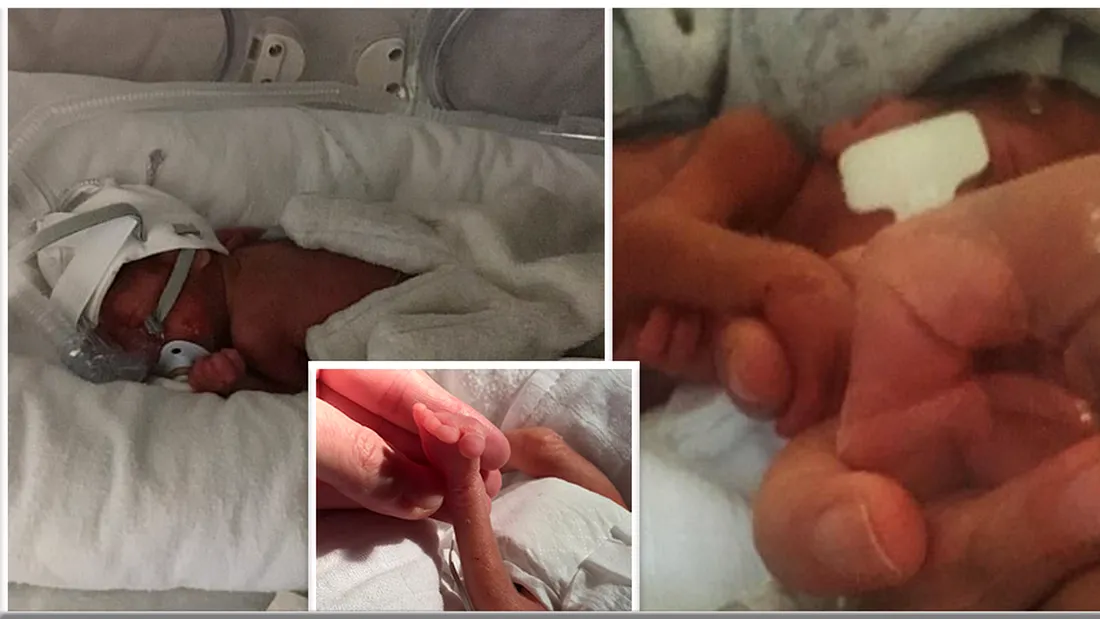 Bebelus nascut prematur, la 23 de saptamani! Medicii nu i-au dat nicio sansa. Ce s-a intamplat dupa 4 luni